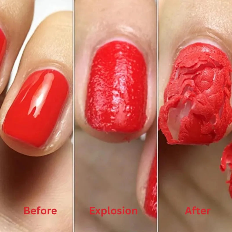 Liventa™ Remover Gel