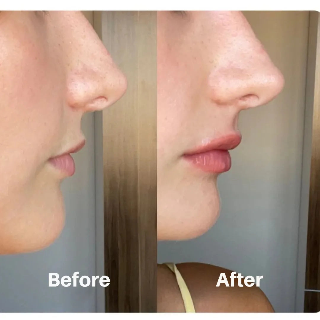 Liventa – For full and luscious lips