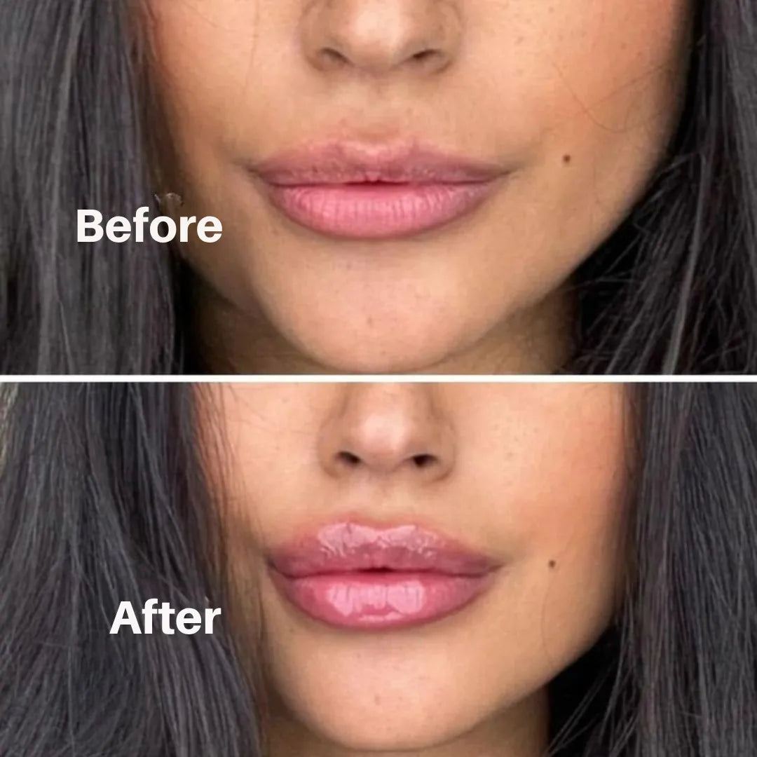 Liventa – For full and luscious lips
