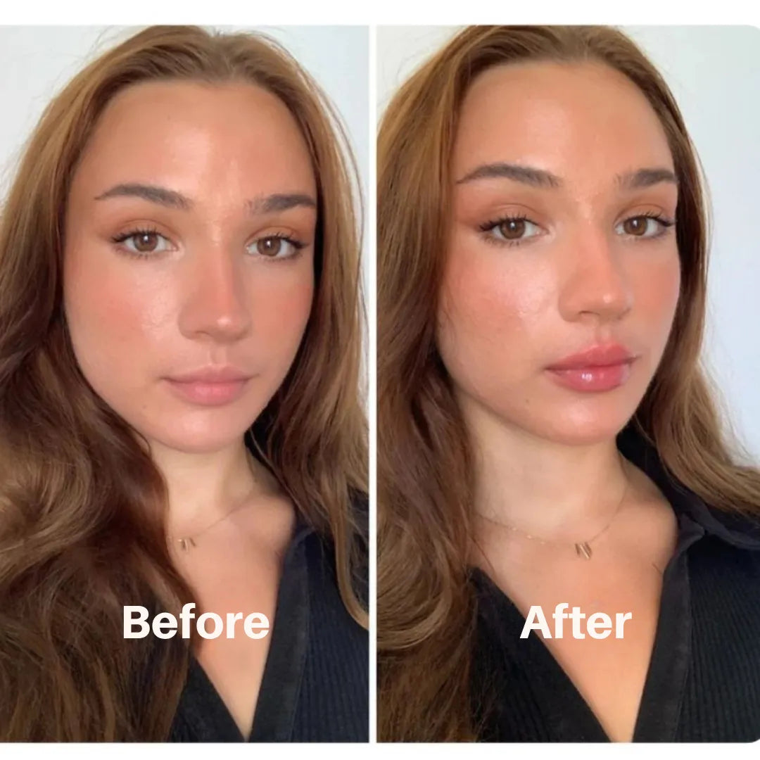 Liventa – For full and luscious lips