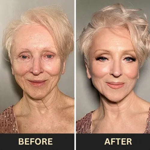Liventa Elixir+ Cream – Perfect skin, effortlessly