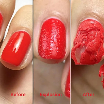 Liventa™ Remover Gel